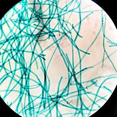 Tolypothrix_(Cyanobacteria)