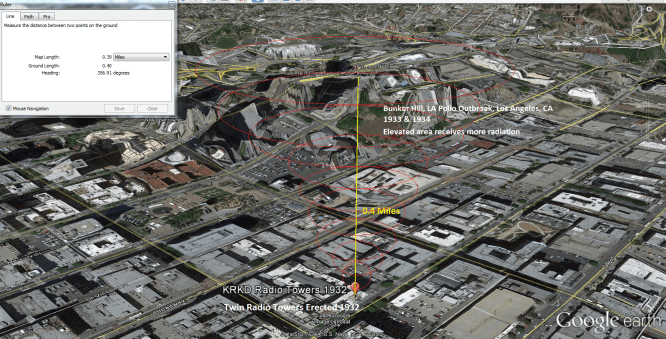 Bunker Hill LA Polio Outbreak